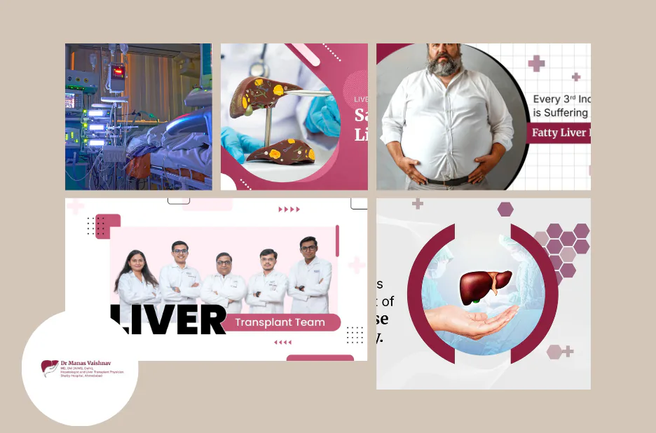 Liver Transplant Surgery in Gujarat – Expert Care and Comprehensive Support in Ahmedabad