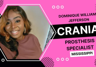 Cranial Prosthesis Specialist | Wigmedical.com