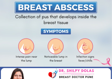 Dr. Shilpy Dolas is a leading specialist for breast cancer treatment in Pune, offering advanced care and support with a focus on long-term healing and recovery.