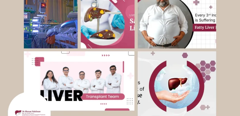 Liver Transplant Surgery in Gujarat – Expert Care and Comprehensive Support in Ahmedabad
