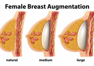 Looking for effective surgical breast treatment in Pune? Dr. Shilpy Dolas offers advanced, minimally invasive surgical options to ensure the best outcomes for her patients.
