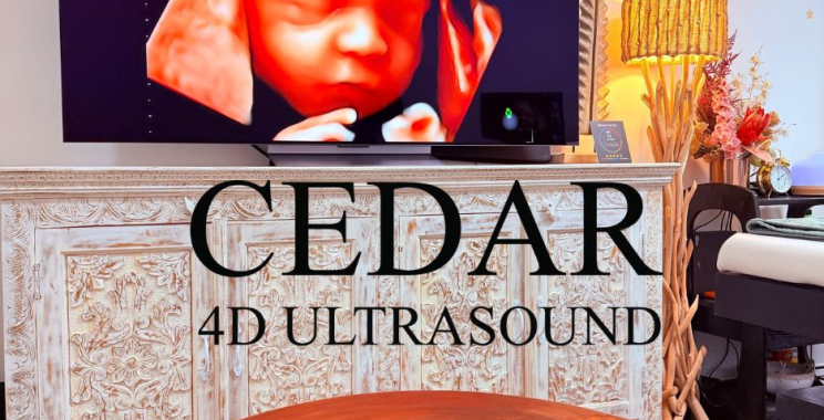 Trusted Pregnancy Scans in Perth’s Leading Imaging Centre