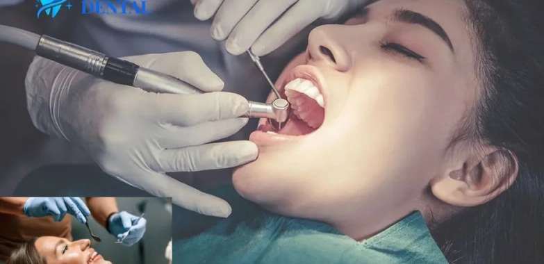 Advanced Digital X Rays for Dental Diagnostics and Personalized Treatment Plans