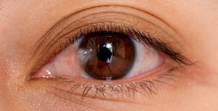 Pterygium Eyedrops: Gentle Relief and Safe Use