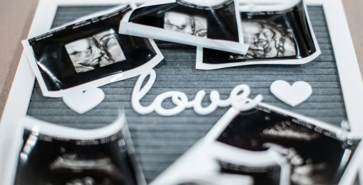 Affordable 4D Baby Ultrasound Perth — Clear Images, Fair Pricing