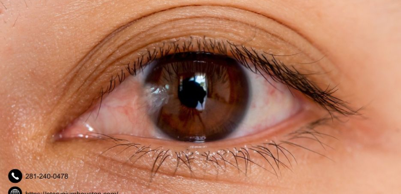 Pterygium Remedy | Pterygiumhouston.com