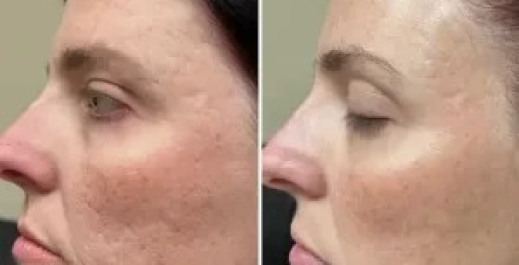 Reveal a younger you: expert skincare options in Oakville