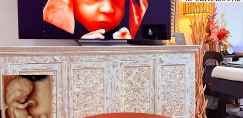 Capture Precious Moments with 3D/4D Keepsake Imaging in Perth