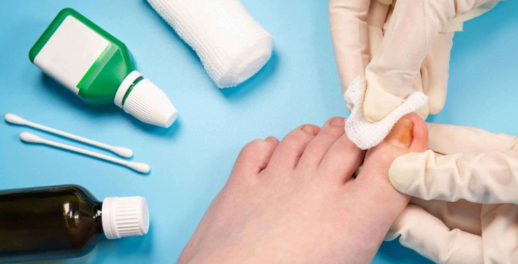 Foot Health for Diabetes: Expert Care in London, Ontario