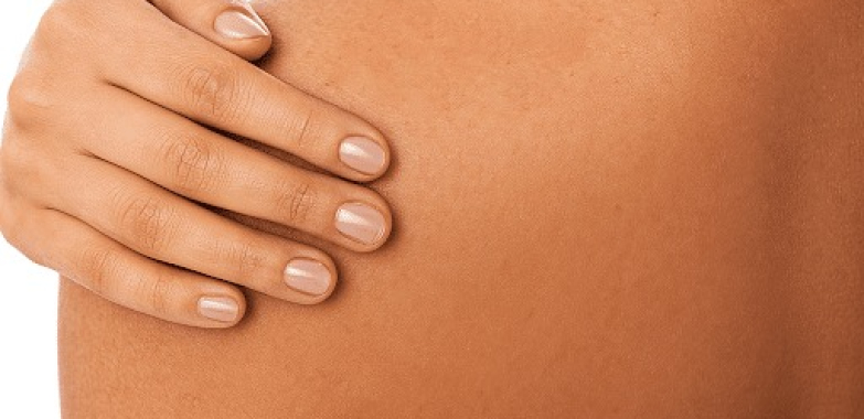 Effective Non-Surgical Vitiligo Solutions in Dubai