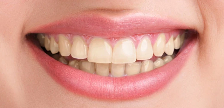 Bright, Friendly Family Dentistry for All Ages