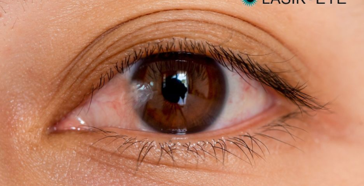 Effective Options for Pterygium Removal and Care