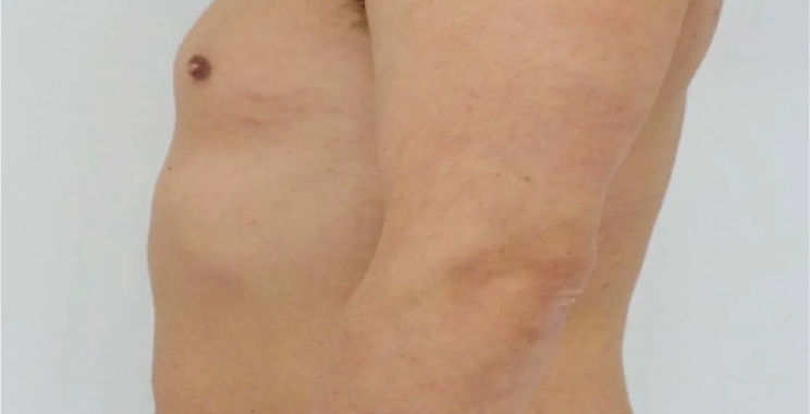 Discover Effective Weight Management: Your Guide to GLP-1 Treatments in Malaysia