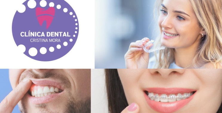 Implants dentals a Gines: solucions per al teu somriure estable