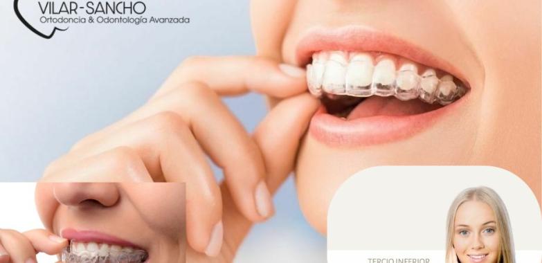 Sonrisa perfecta en Pozuelo: tu clínica de confianza
