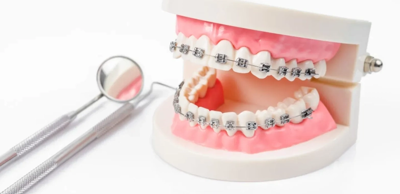 Affordable Invisalign Treatments: What to Expect and Save