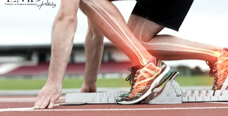 Relief for a Painful Foot Callus: Safe, Effective Care