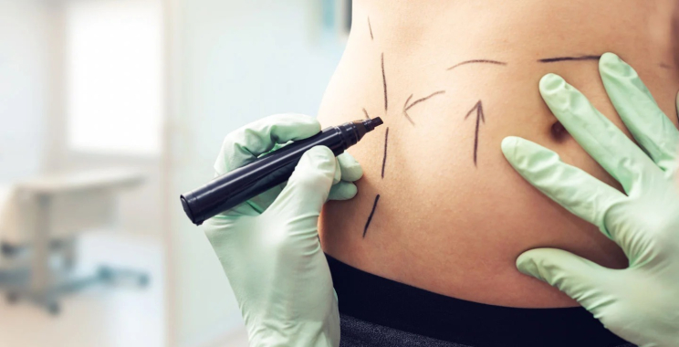 Top Facial Plastic Surgeon in Australia for Natural Results