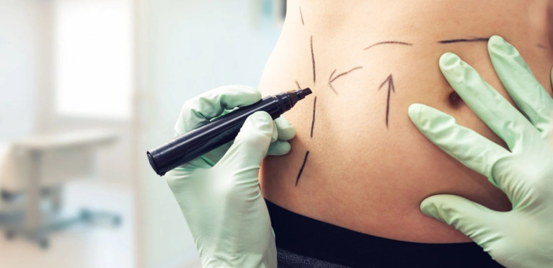 Top Facial Plastic Surgeon in Australia for Natural Results