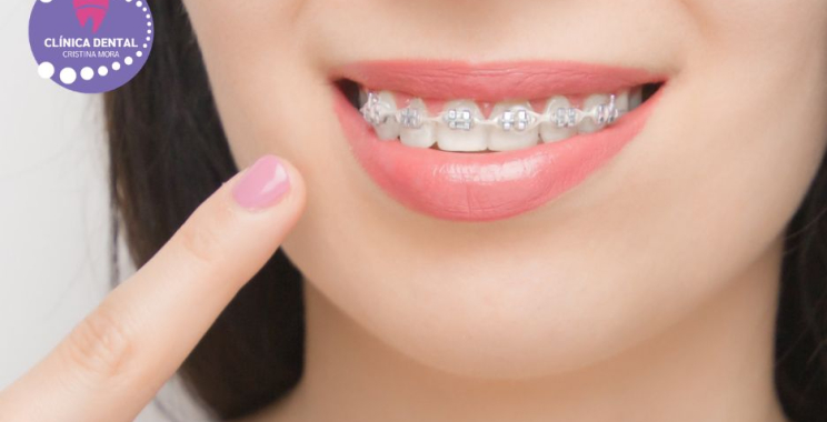 Somriure brillant a Gines: blanquejat dental eficient i segur