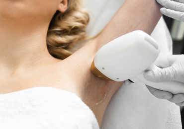 Smooth Skin Starts Here – Laser Hair Removal in Edmonton