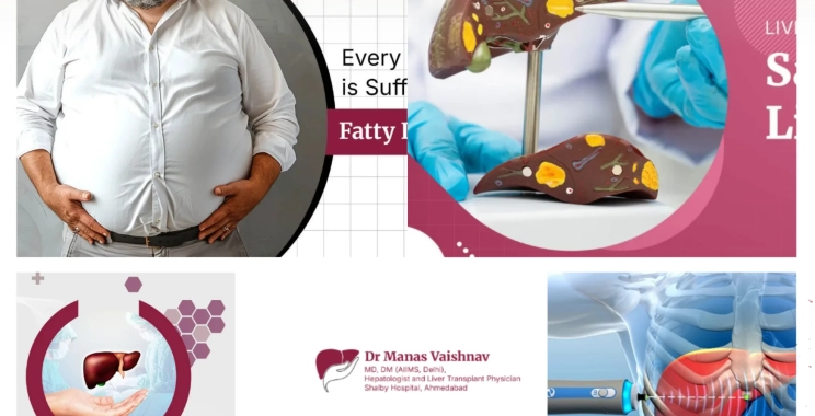 Top Liver Cirrhosis Specialist in Ahmedabad for Advanced Diagnosis and Treatment