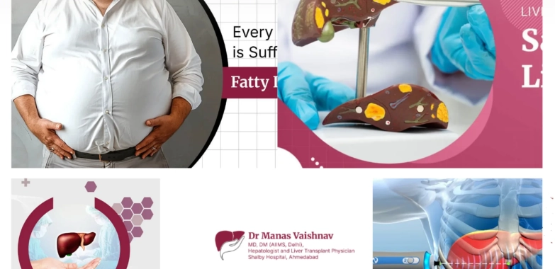 Top Liver Cirrhosis Specialist in Ahmedabad for Advanced Diagnosis and Treatment